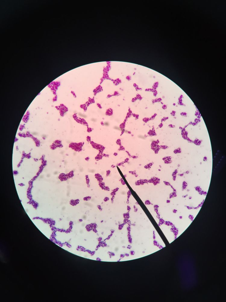 Clostridium botulinum