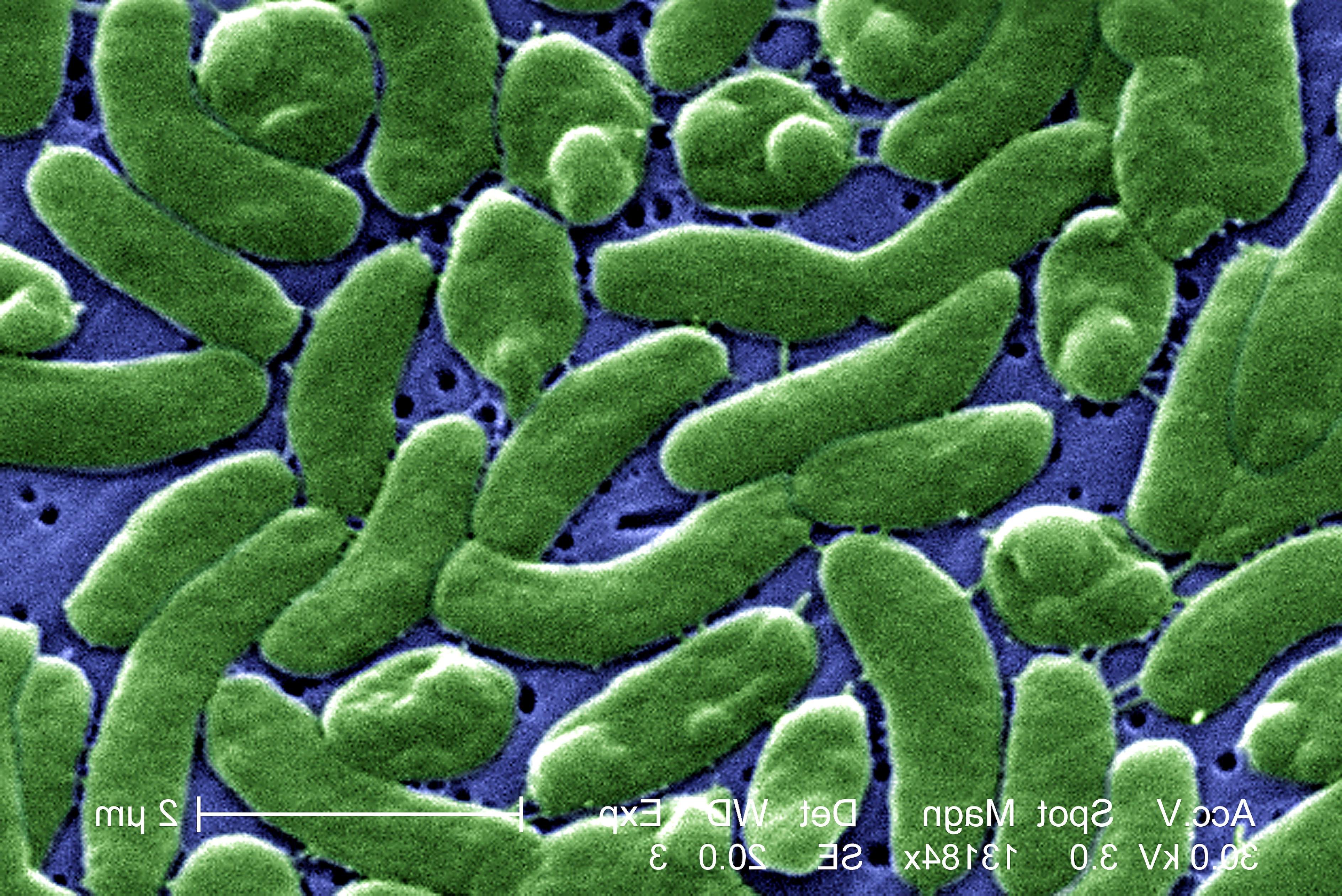 Grouping cells, vibrio vulnificus, bacteria, photomicrograph.
